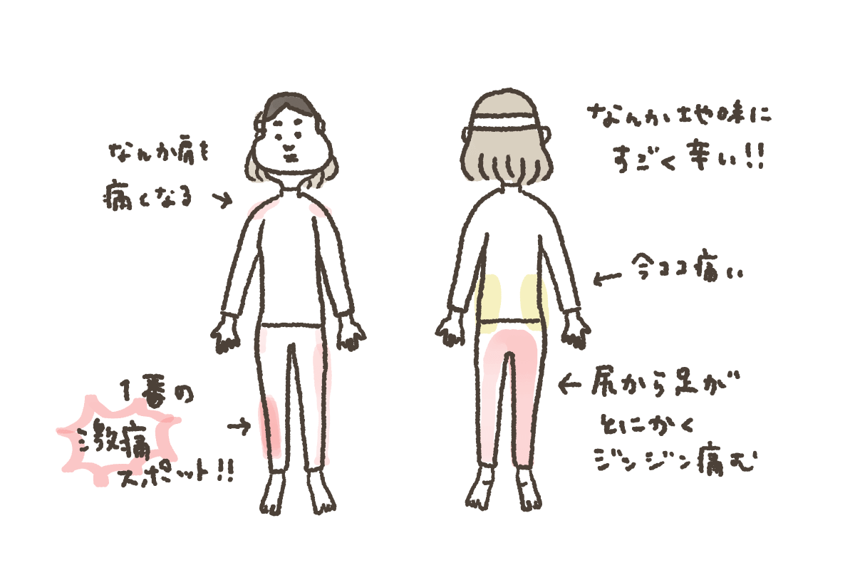 痛みの場所を説明するイラスト 痛みの場所を説明するイラスト