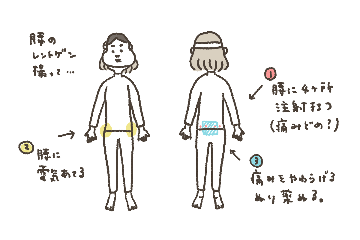 足腰の痛みで私が受けた治療を説明するイラスト 足腰の痛みで私が受けた治療を説明するイラスト