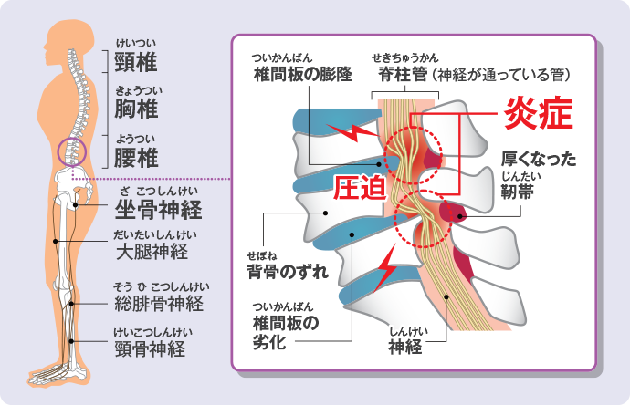 f:id:sunao-hiroba:20190810113029p:plain