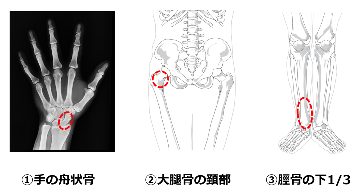 f:id:sunao-hiroba:20210306143637p:plain