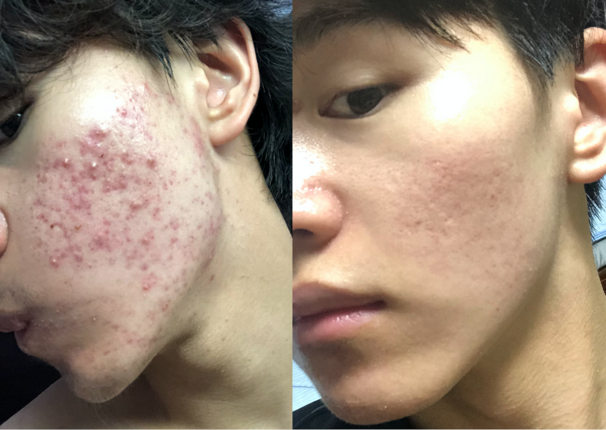 f:id:sunflower01:20200729173926p:plain