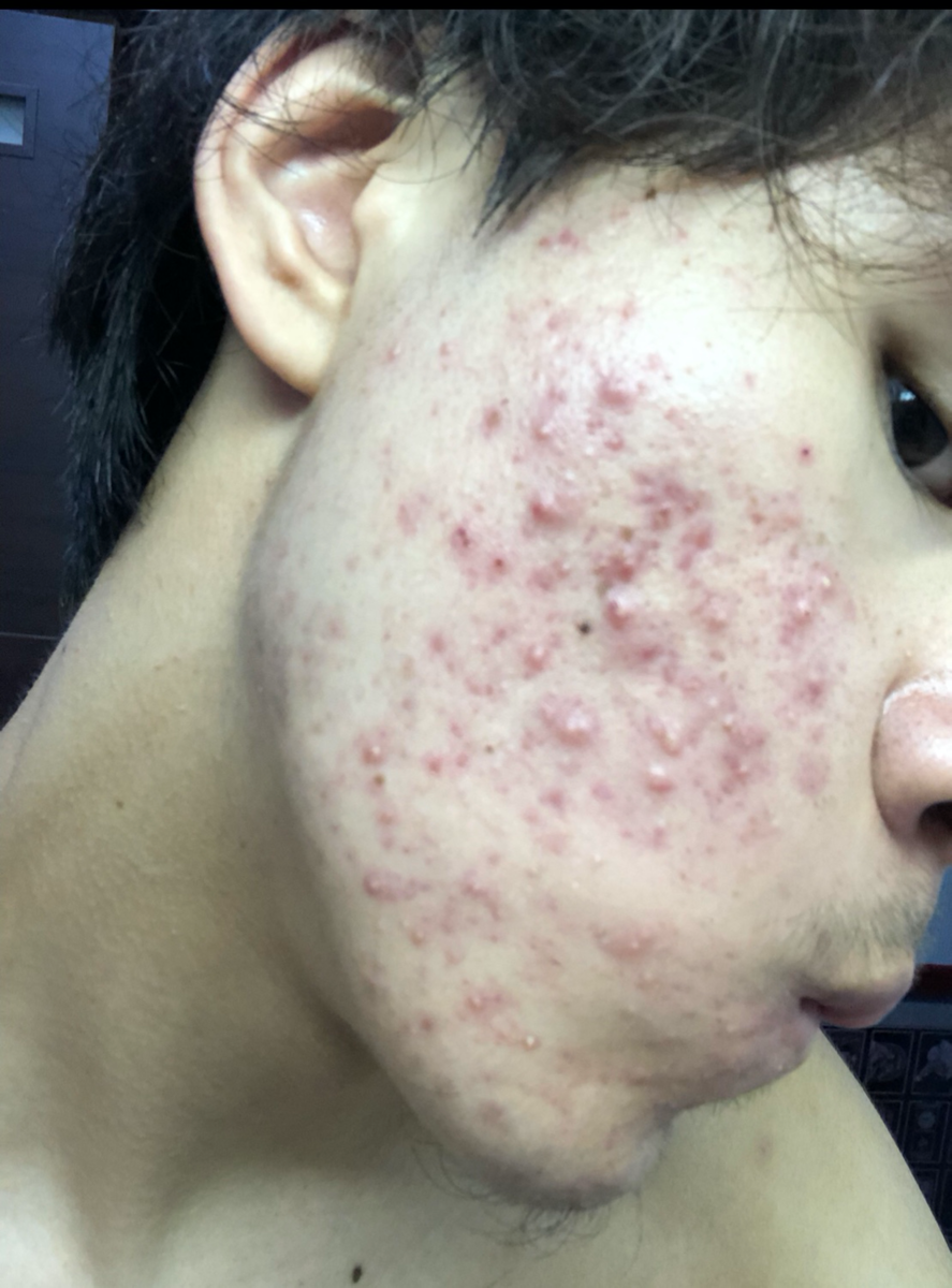 f:id:sunflower01:20200802020739p:plain