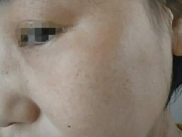 パーフェクトワン使用あり