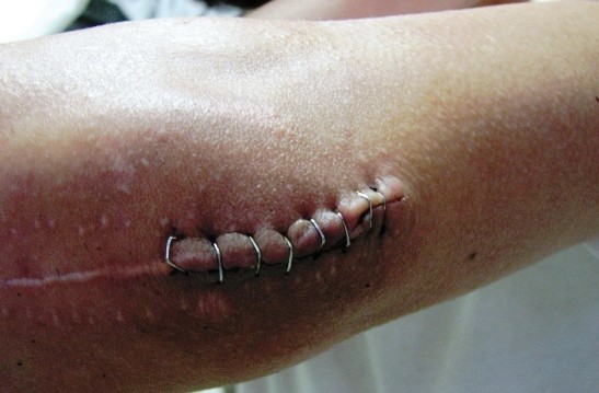 f:id:sunny4649:20080612224150j:image:h240:w380 f:id:sunny4649:20080612224150j:image:h240:w380