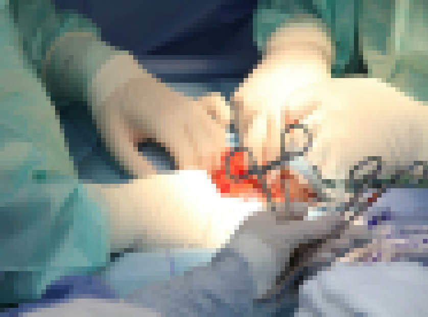 f:id:suppleranger:20170830111218j:plain