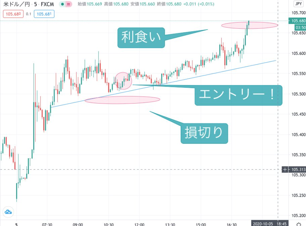 f:id:surgeonkazu:20201020151934p:plain
