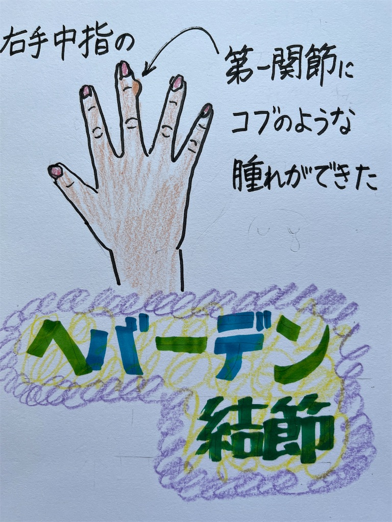 f:id:sutekidane:20240613195017j:image f:id:sutekidane:20240613195017j:image