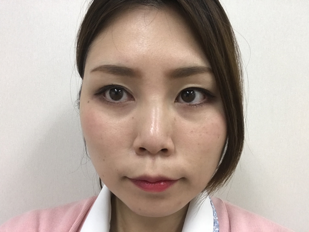 f:id:suzunasu:20180119154725j:plain f:id:suzunasu:20180119154725j:plain