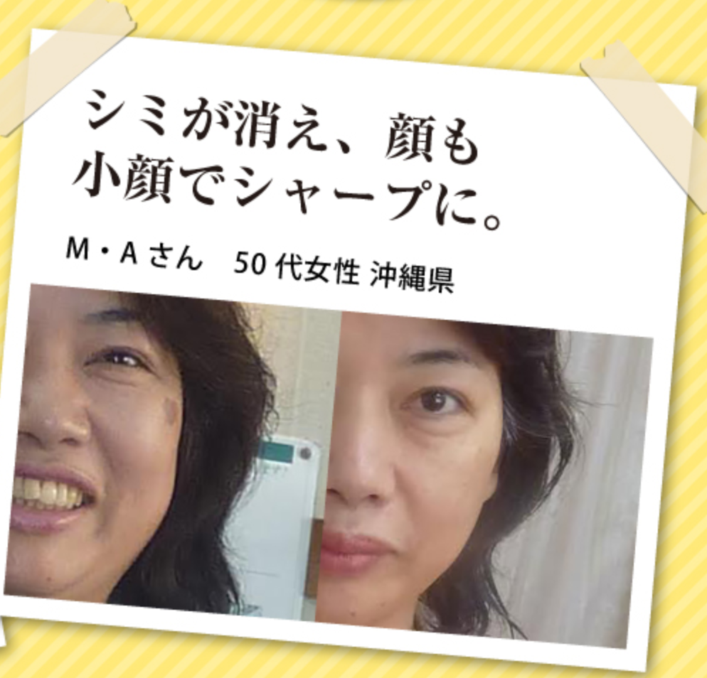 f:id:svam6479:20180503160022p:plain f:id:svam6479:20180503160022p:plain