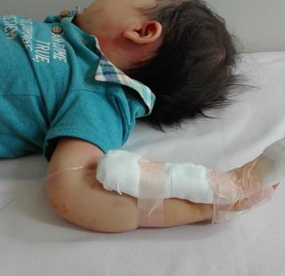 ２歳２か月 多形滲出性紅斑で入院になるまでのこと 猫の手も借りたい 高齢ママの育児日記