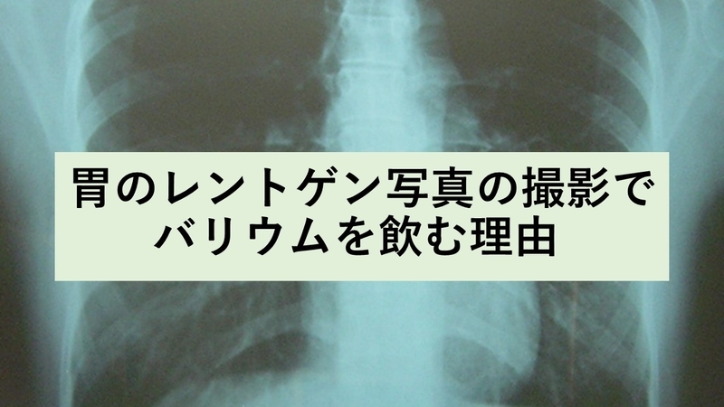 胃のレントゲン写真の撮影でバリウムを飲む理由 化学徒の備忘録 かがろく 化学系ブログ