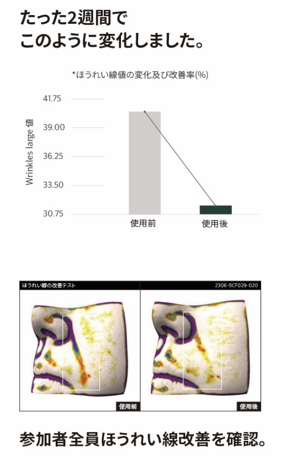 美容師レビュー】メディトールド研究所のアクシークリーム(AACI