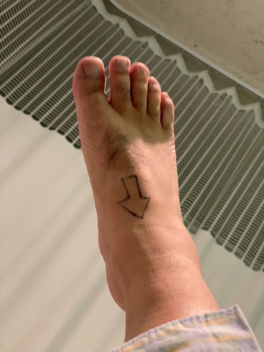 f:id:synechocystis:20200304202545j:plain