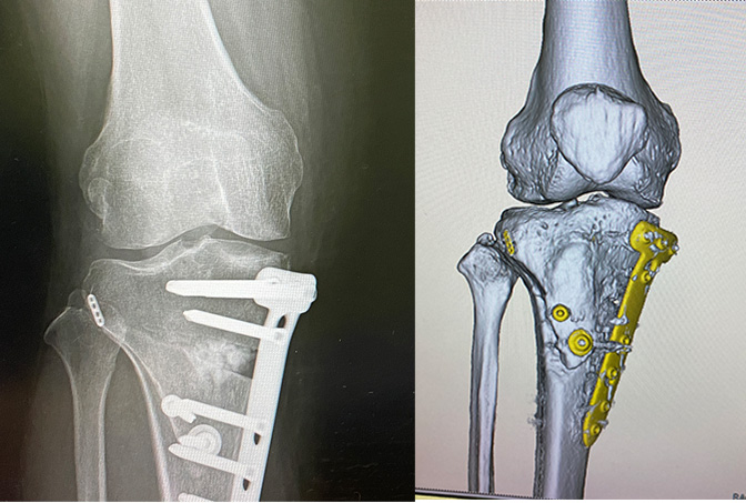 f:id:synechocystis:20210329181813j:plain