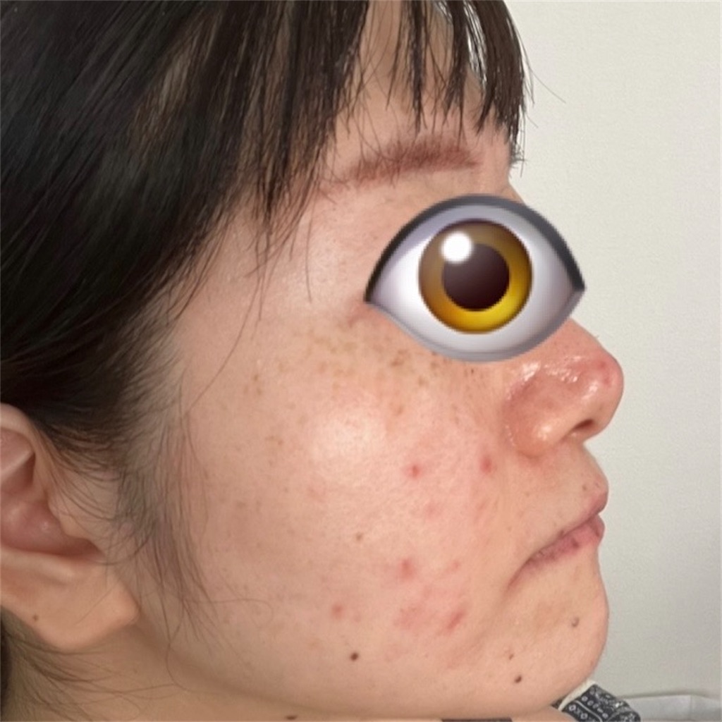 f:id:syrup0215:20241213105452j:image