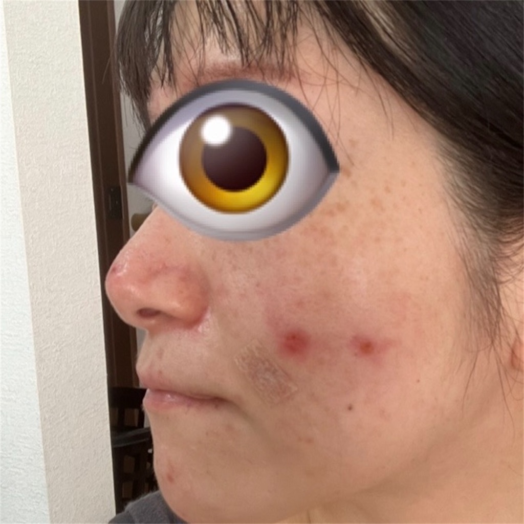 f:id:syrup0215:20241213105456j:image