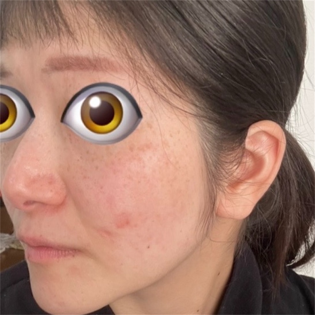 f:id:syrup0215:20241213105729j:image