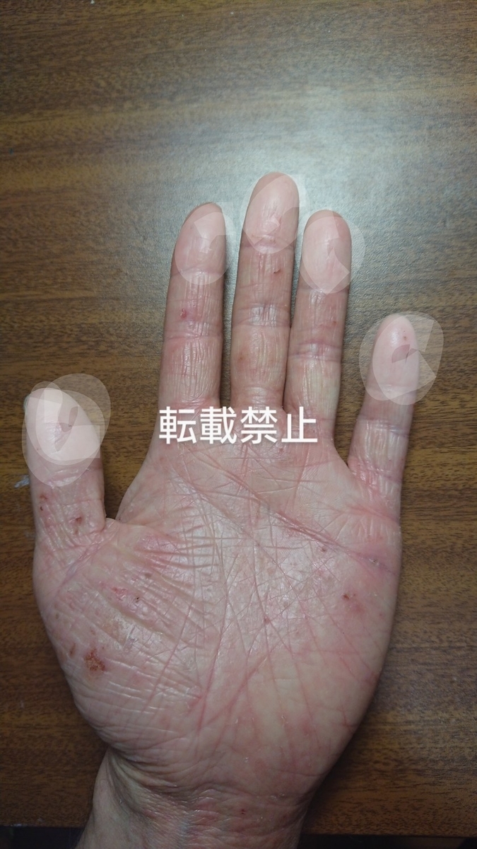 f:id:t-kichi:20200717215533j:plain f:id:t-kichi:20200717215533j:plain