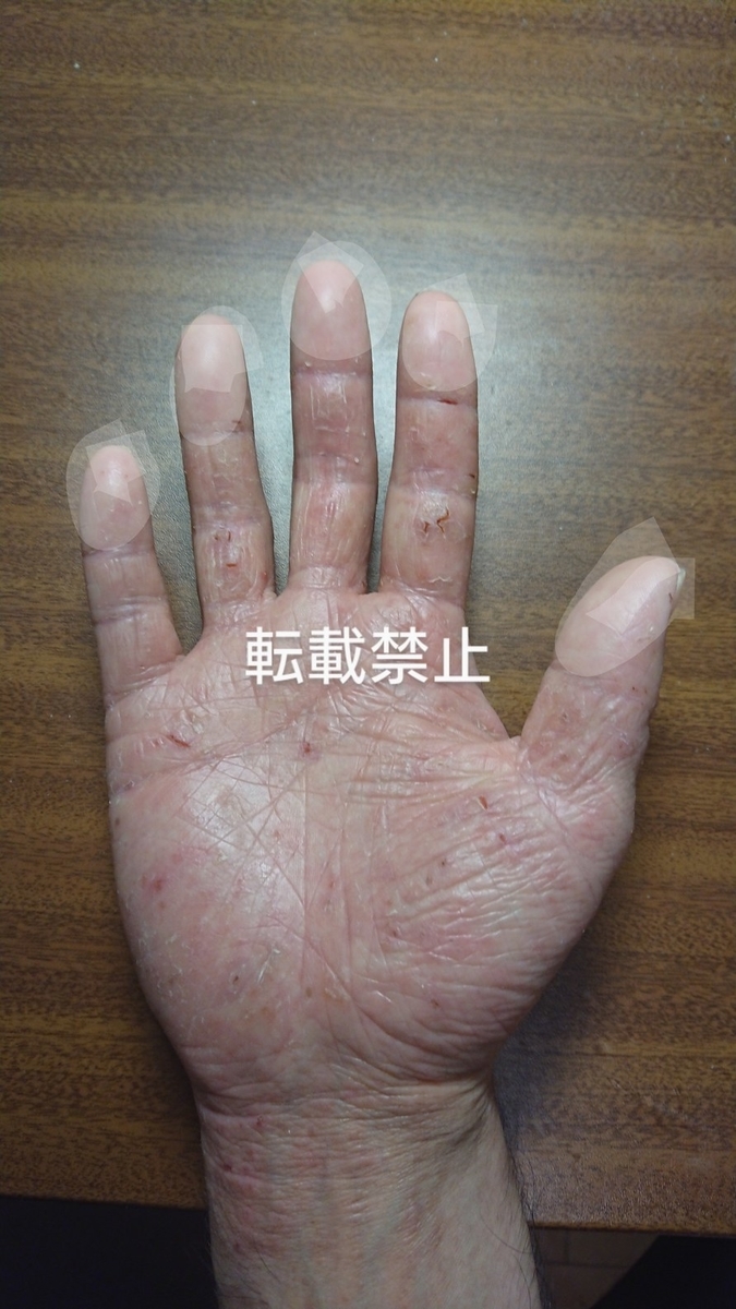 f:id:t-kichi:20200717215606j:plain f:id:t-kichi:20200717215606j:plain