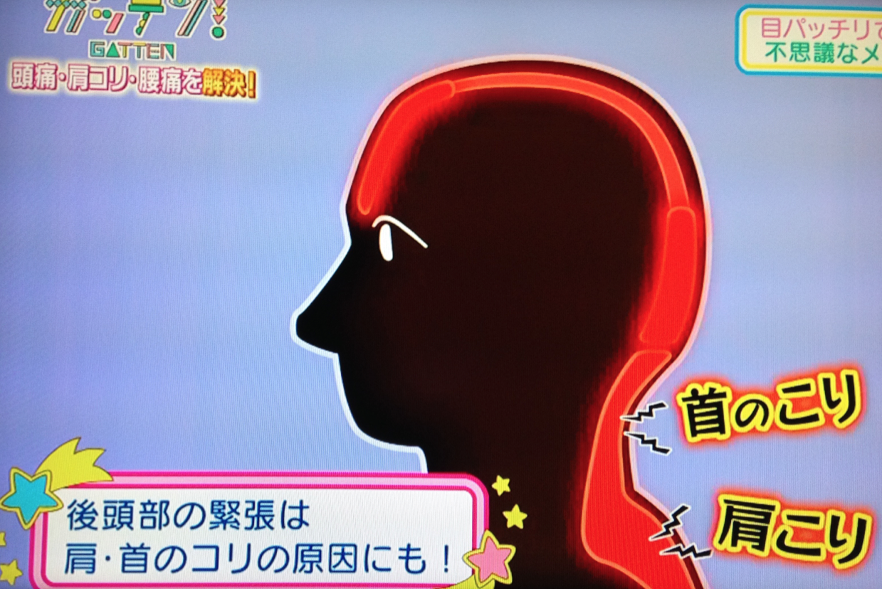 f:id:t_aki:20160814102514p:plain:h150,w200