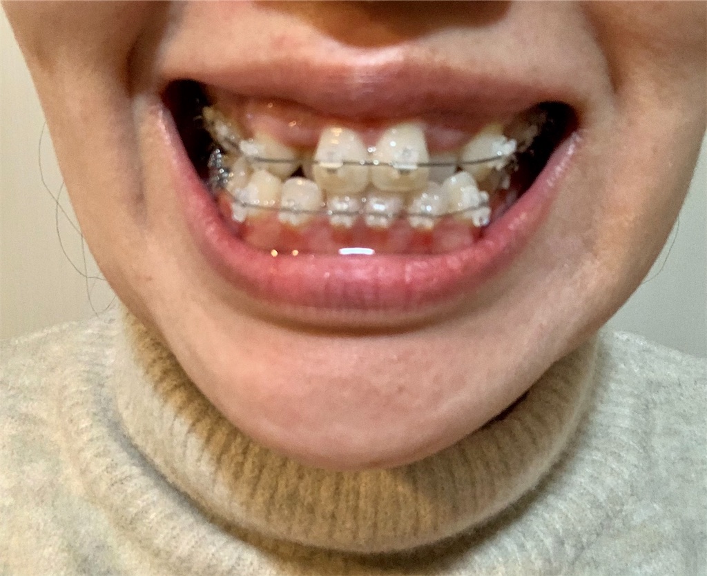 f:id:tabi-log:20220115184910j:image f:id:tabi-log:20220115184910j:image