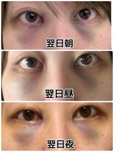 f:id:tabishite_korea:20210416145433j:image f:id:tabishite_korea:20210416145433j:image