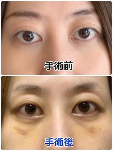 f:id:tabishite_korea:20210426100235j:image f:id:tabishite_korea:20210426100235j:image