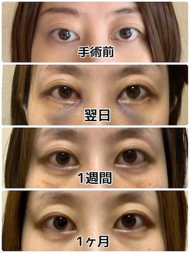 f:id:tabishite_korea:20210516092234j:image f:id:tabishite_korea:20210516092234j:image