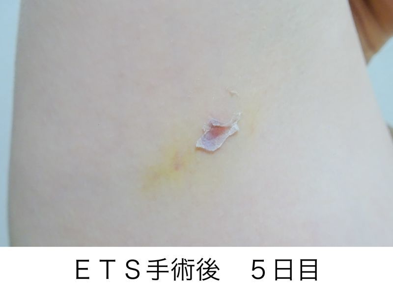 f:id:tabitogohan:20210525204049j:plain