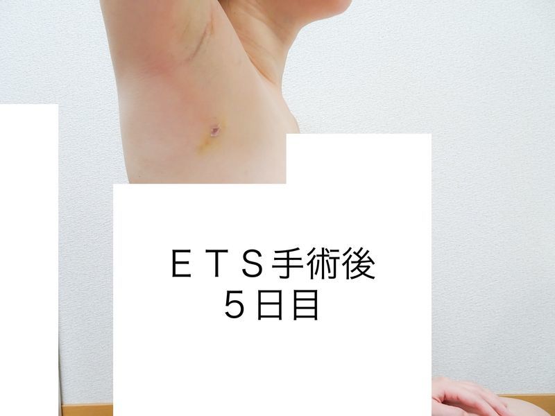 f:id:tabitogohan:20210525204125j:plain