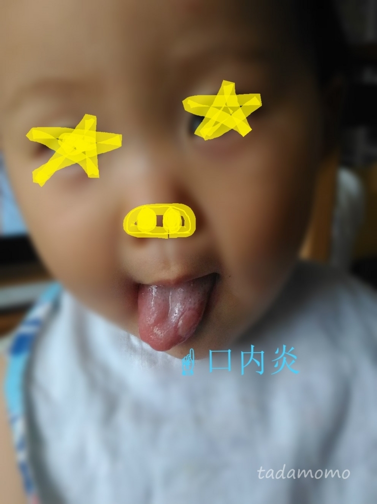 f:id:tadamomo:20170705205241j:plain f:id:tadamomo:20170705205241j:plain