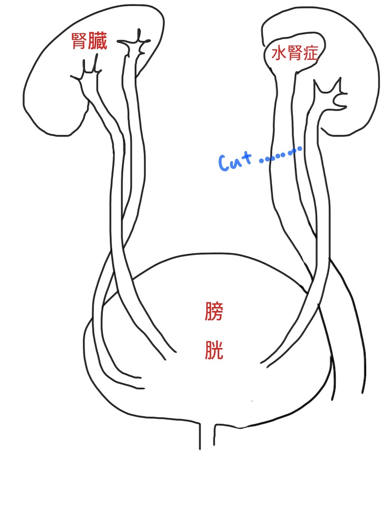 f:id:tadamomo:20180109192228j:image f:id:tadamomo:20180109192228j:image