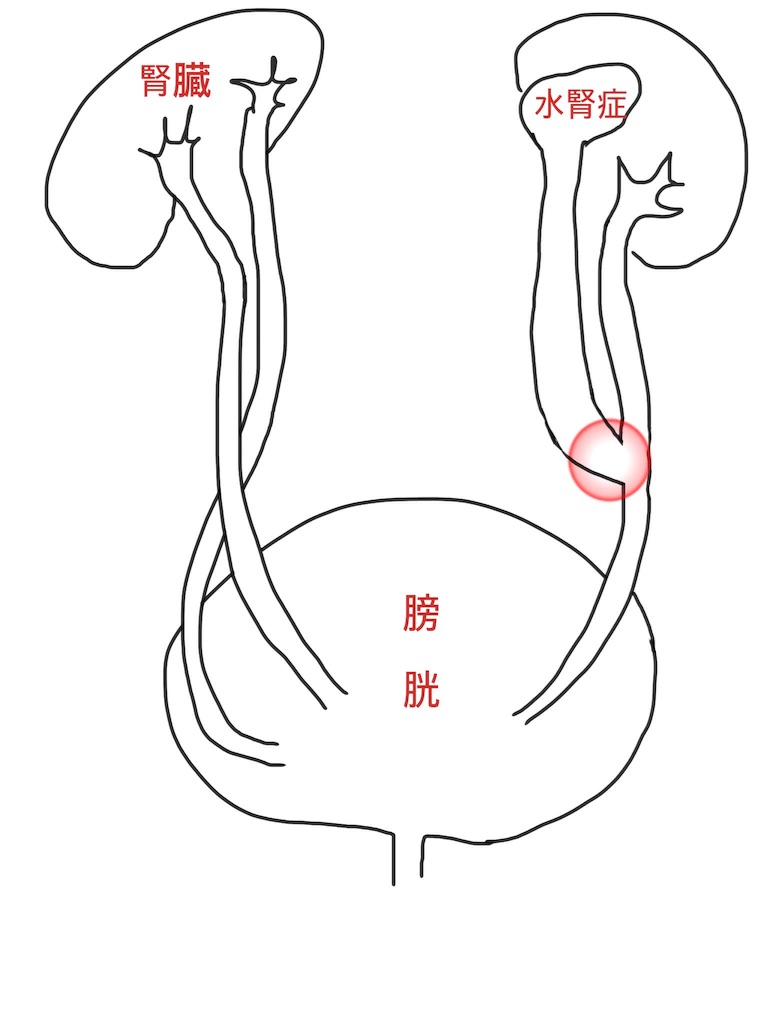 f:id:tadamomo:20180109192236j:image f:id:tadamomo:20180109192236j:image