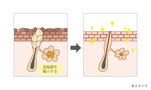 f:id:tadanoomochi:20191009214953p:plain