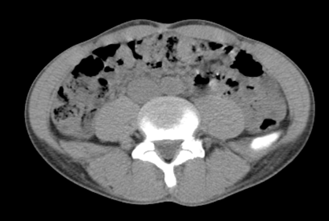 f:id:taisakovic:20210515110950p:plain