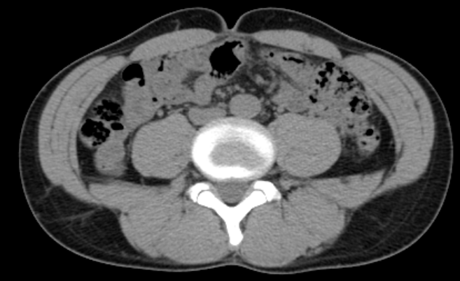 f:id:taisakovic:20210515111459p:plain