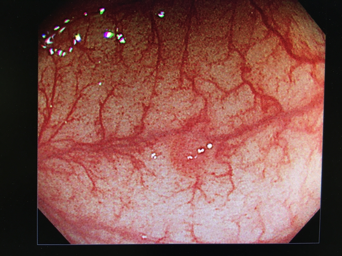 回復するまでどれくらい時間がかかりますか?