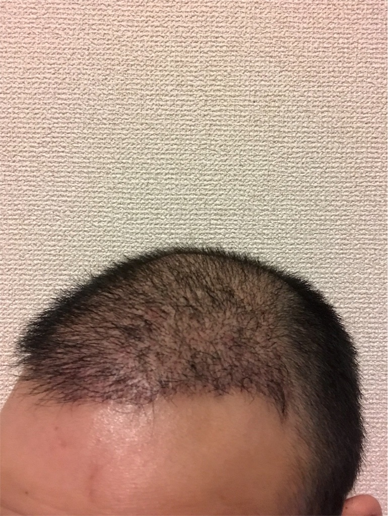 f:id:tak1783:20180731011849j:image