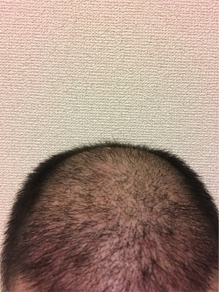 f:id:tak1783:20180731011929j:image