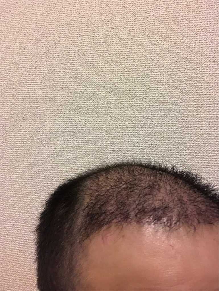 f:id:tak1783:20180808211726j:image