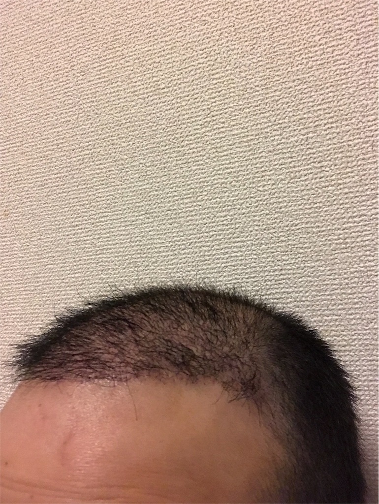 f:id:tak1783:20180808211730j:image