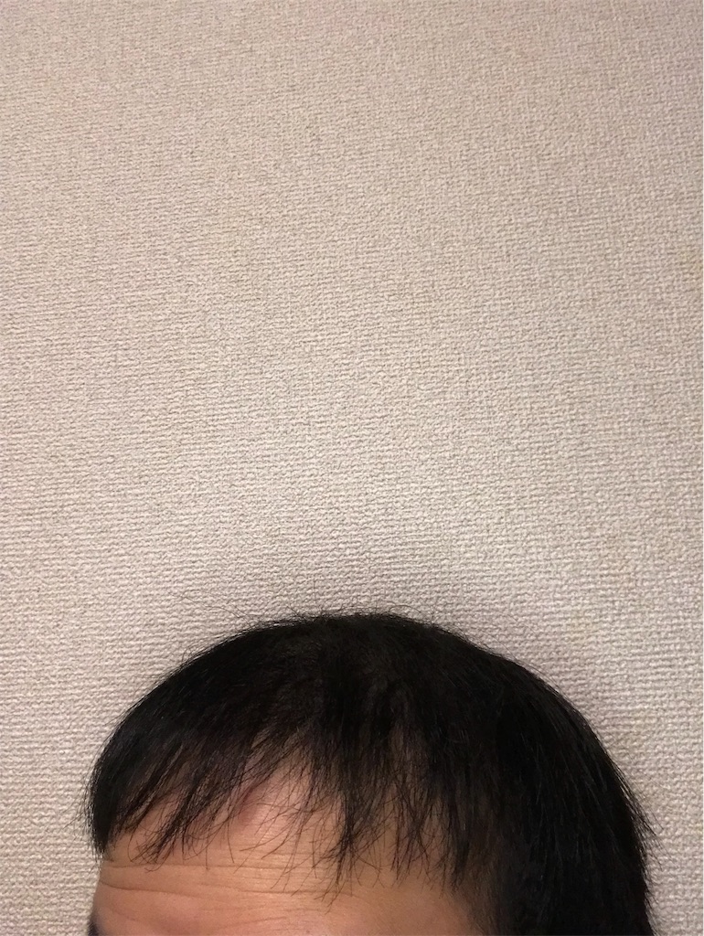 f:id:tak1783:20181229103621j:image