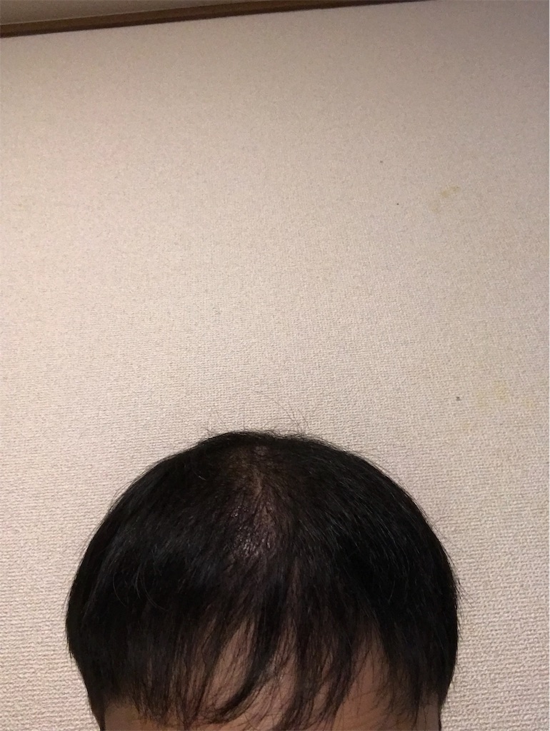 f:id:tak1783:20181229103629j:image