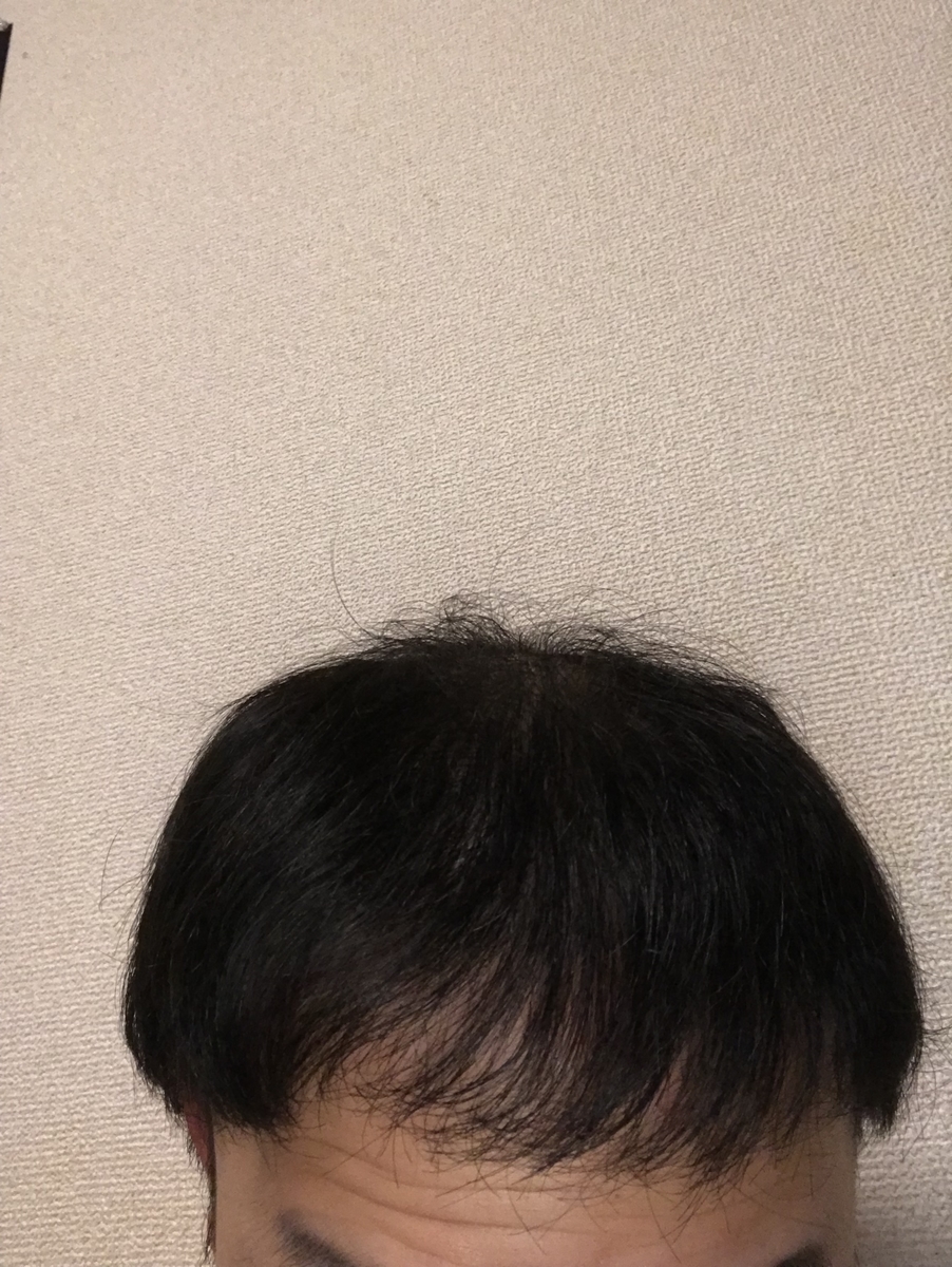 f:id:tak1783:20190330115128j:plain
