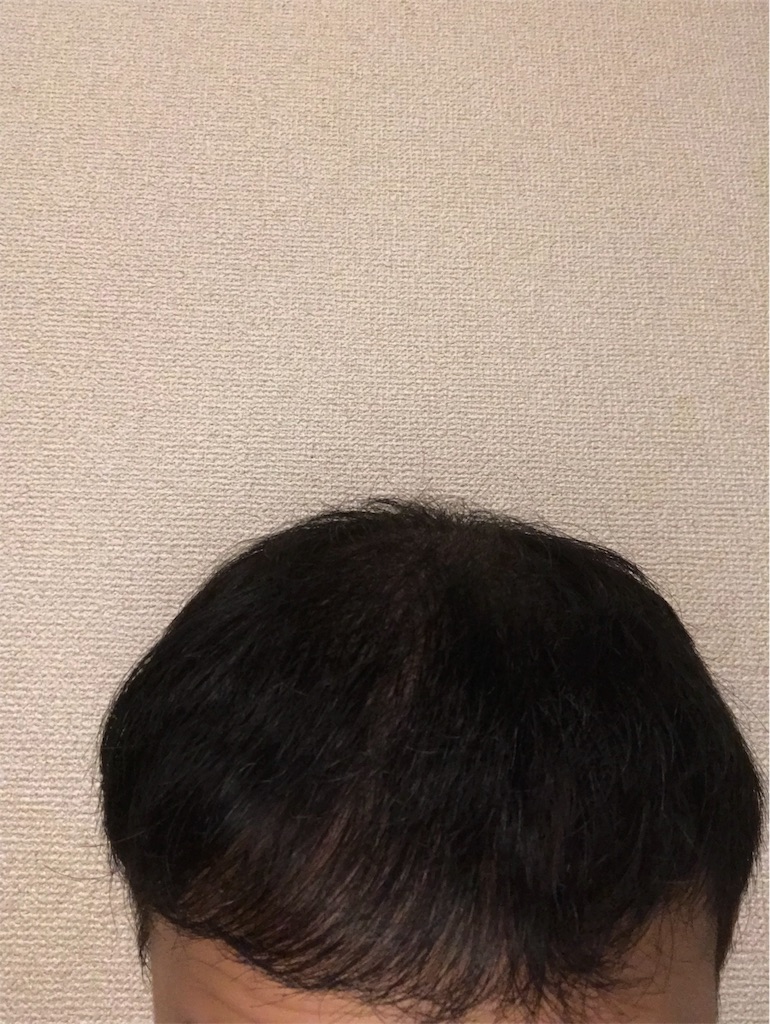 f:id:tak1783:20190530225202j:image