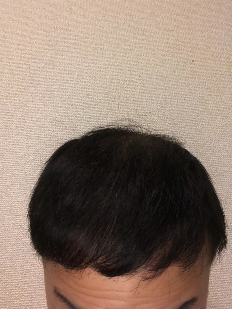 f:id:tak1783:20190630014904j:image