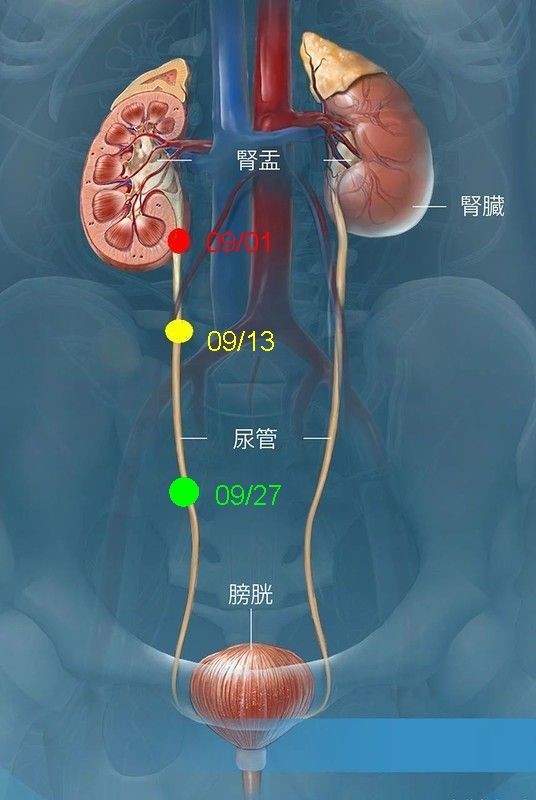 f:id:takajun7777:20191001111021j:plain f:id:takajun7777:20191001111021j:plain
