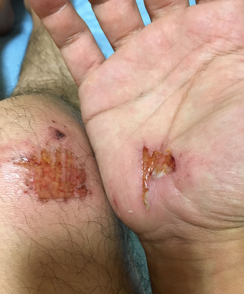 f:id:takam0:20170801003149j:plain f:id:takam0:20170801003149j:plain