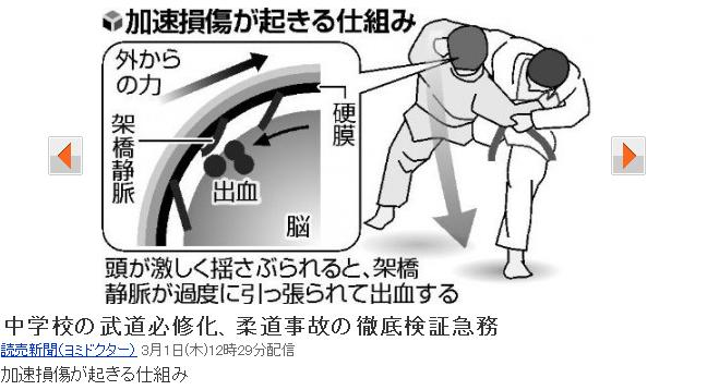 脳の加速損傷