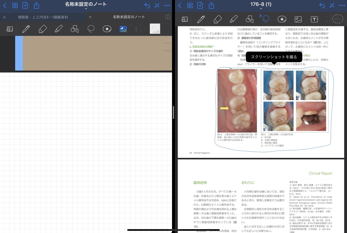 f:id:takashineozeon:20210515213752j:plain